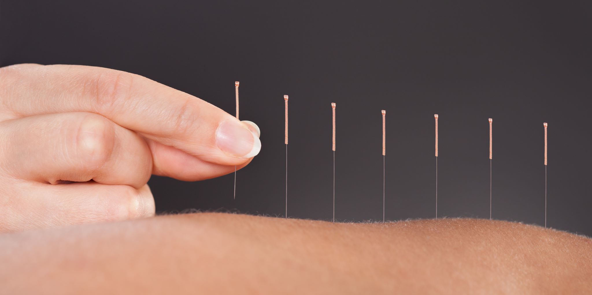 Acu Healthy Life - Acupuncture Specialty Center